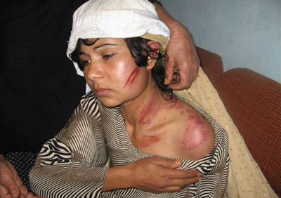 Mulher afegã vítima de violação e agressão